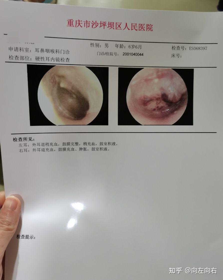 耳朵充血图片图片