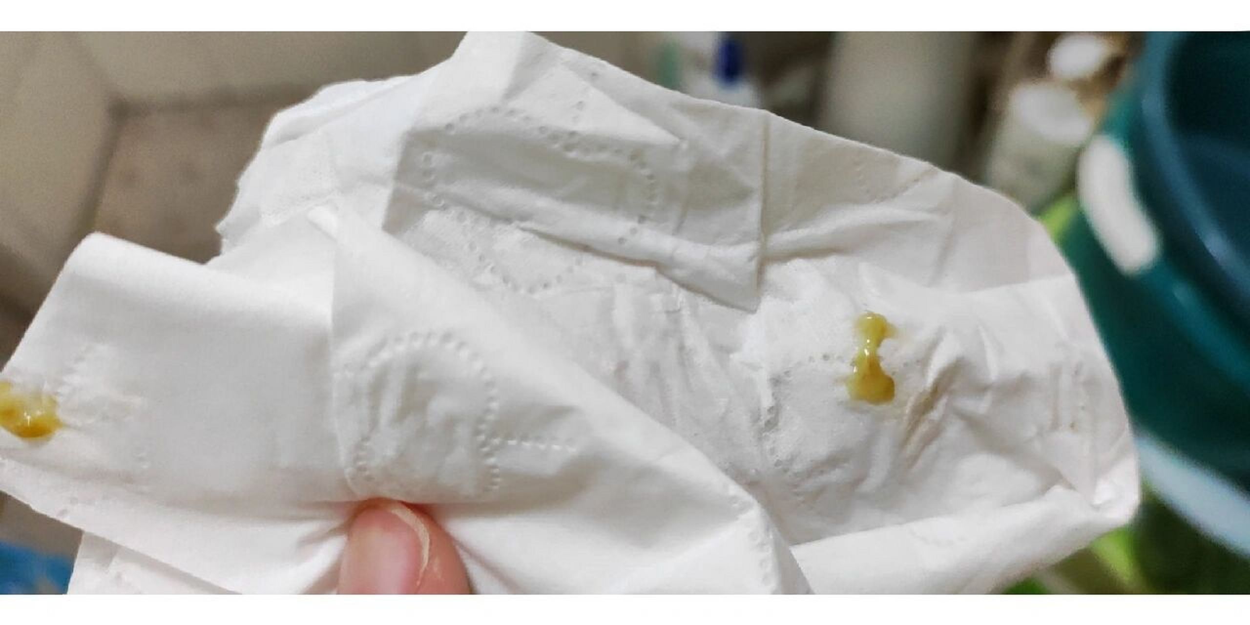 婴儿有浓黄鼻屎处理办法,实测有效!