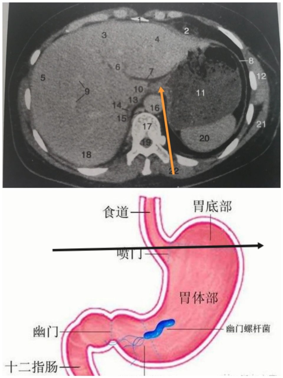 贲门是什么位置图片图片