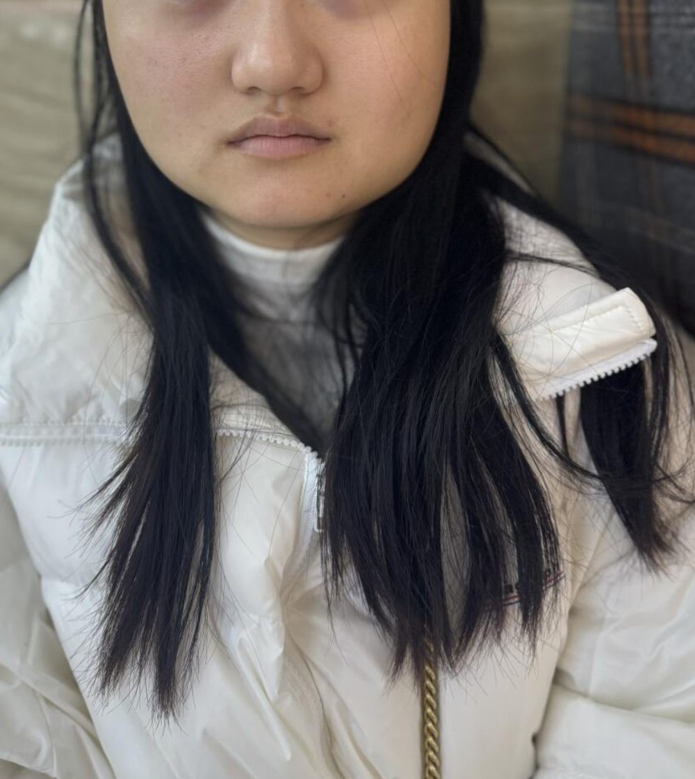 脸部不对称嘴歪怎么纠正?