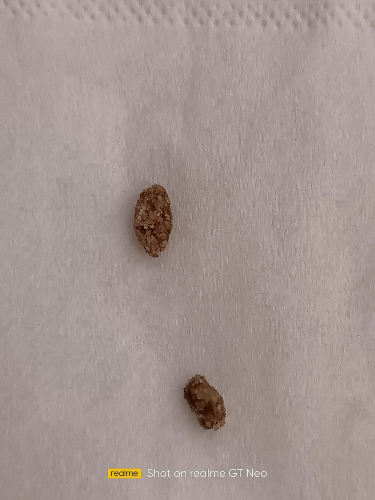 求助一下,我家鼠鼠便便是这样子的,正常吗