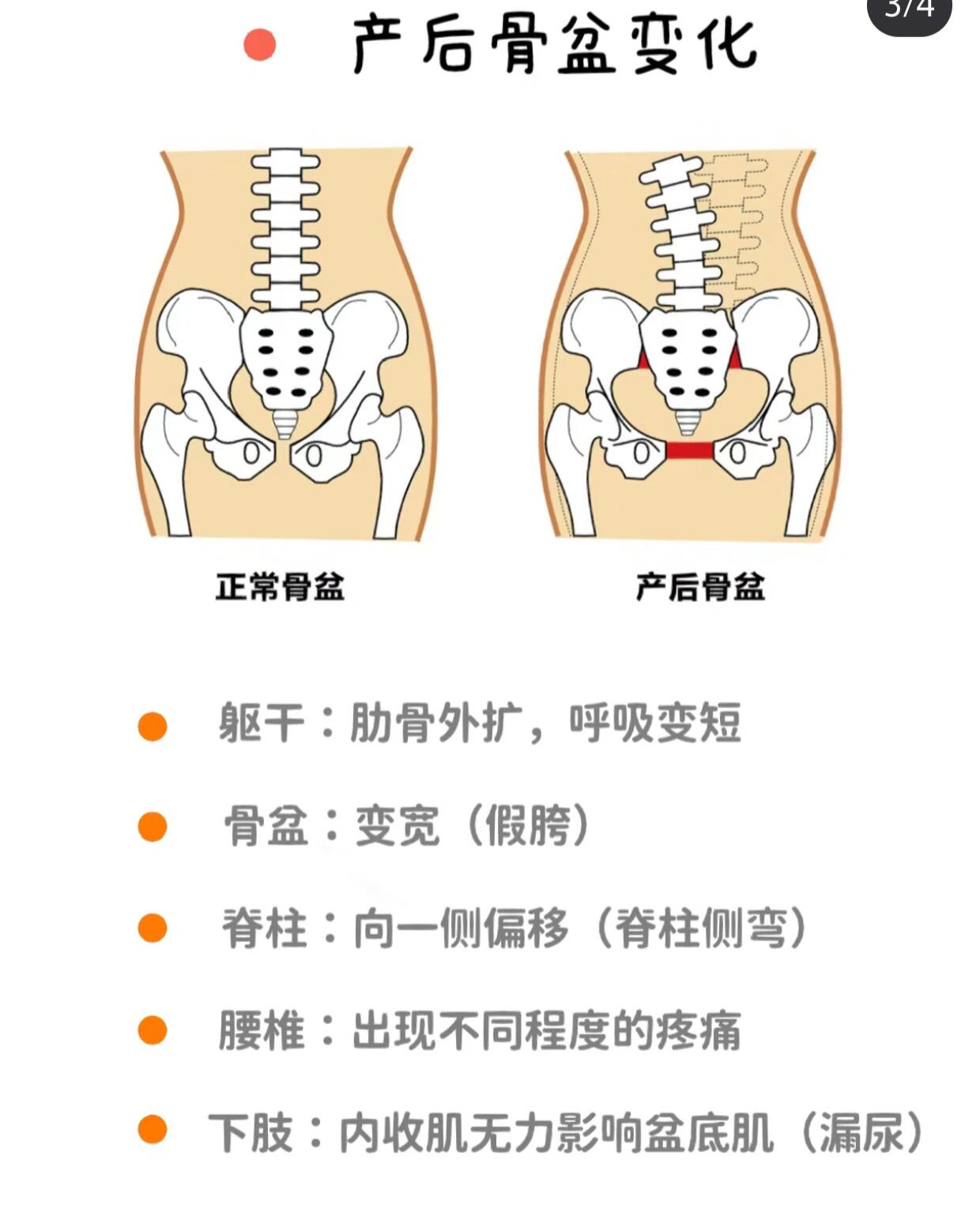 新手瑜伽老师必备‖女性骨盆的解剖知识