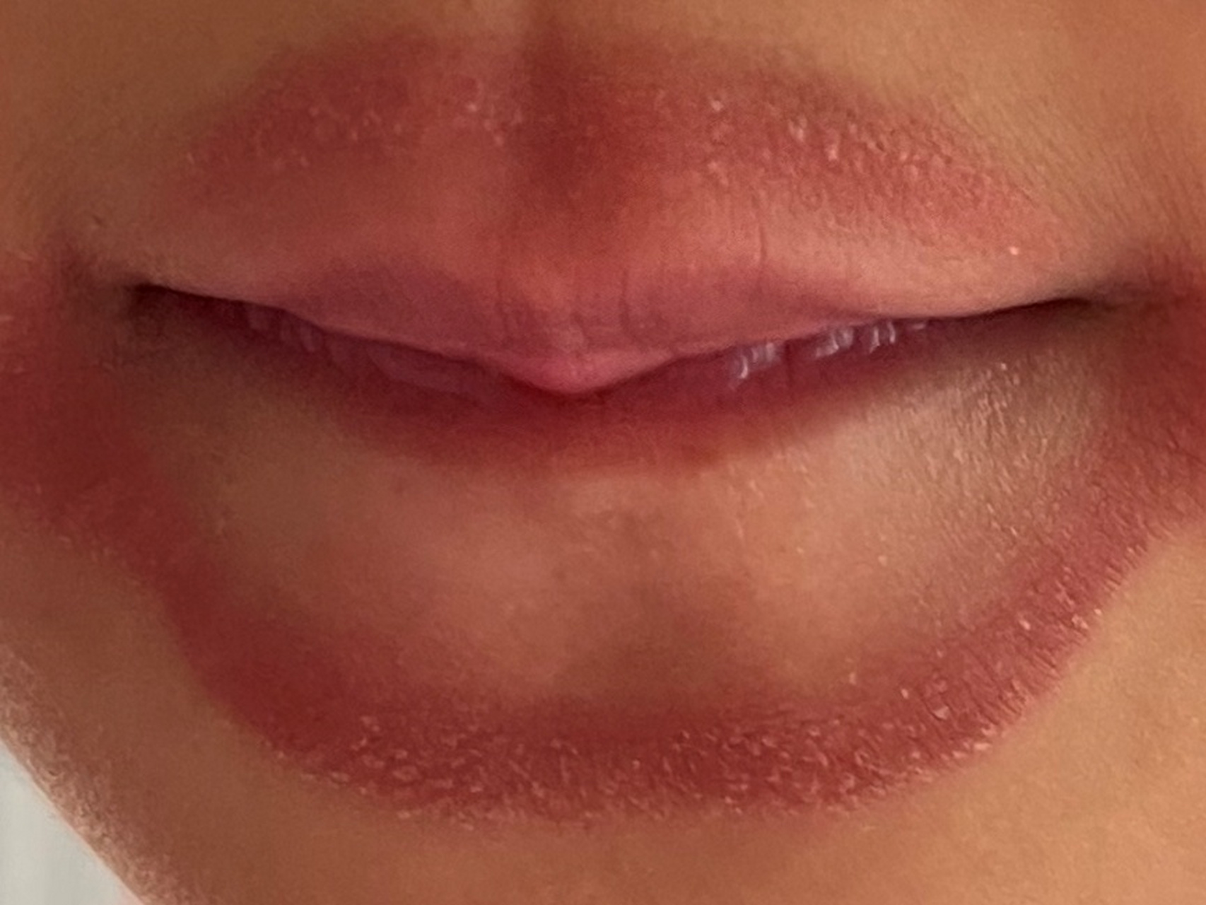 嘴唇发红是什么原因?图片