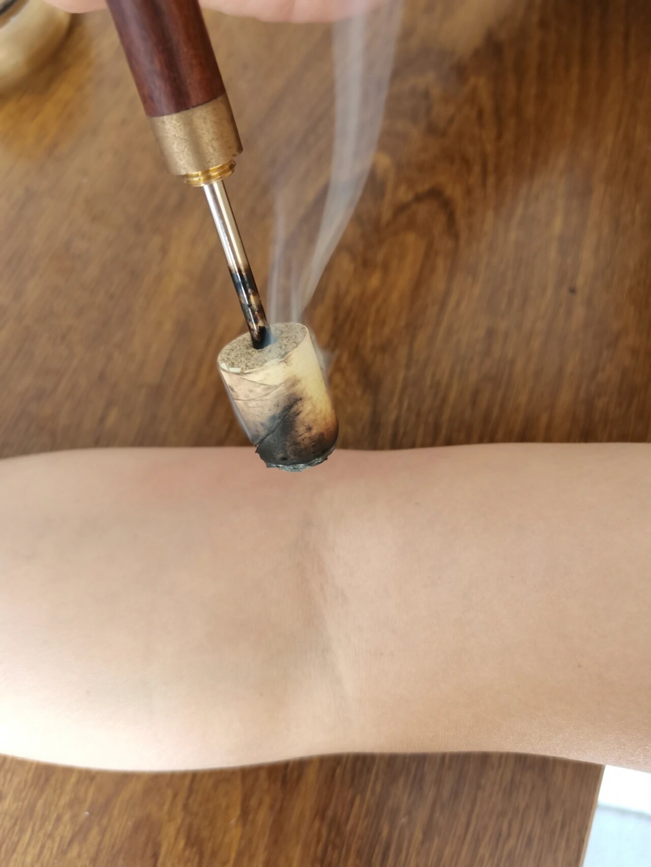 灸3个穴位,缓解肘关节酸痛 生了女儿以后,刚好3月份做月子,月子里经常