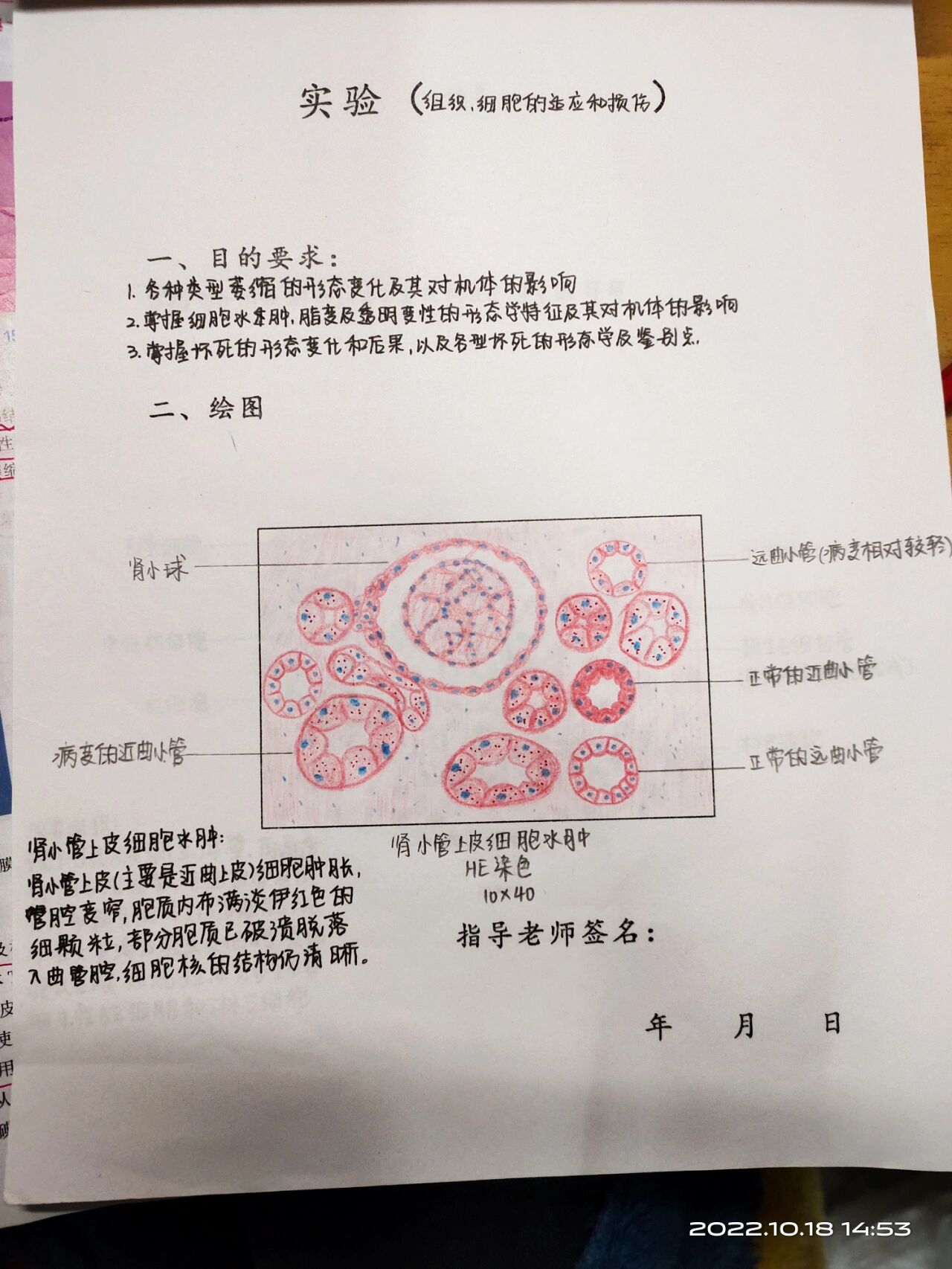 细胞水肿绘图图片