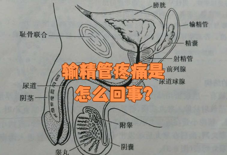 输精管疼痛最常见的原因是炎症,比如急性输精管炎或慢性输精管. 