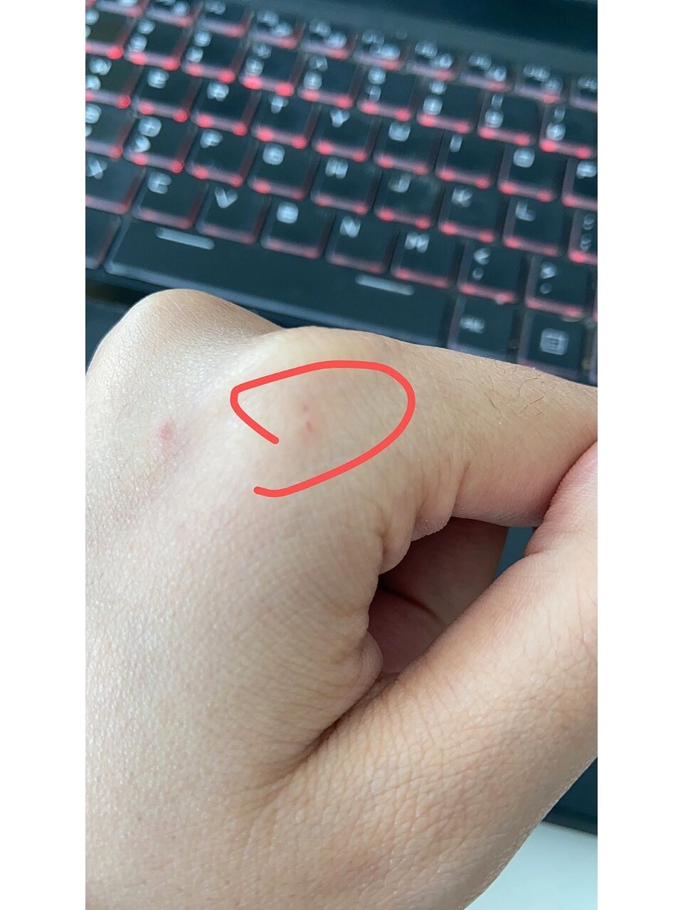 被猫咪抓破皮要打狂犬疫苗吗?