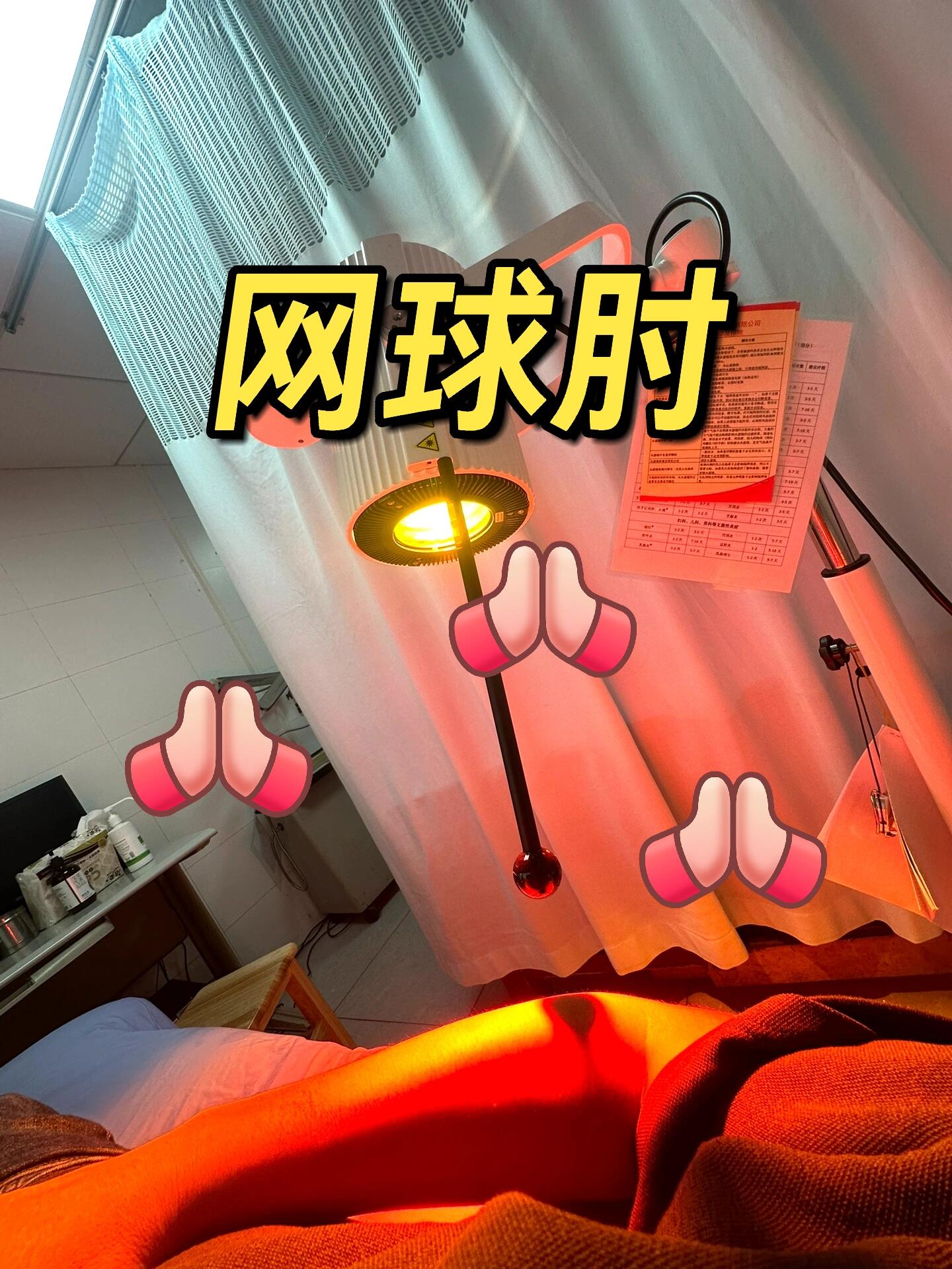 亲测:网球肘治疗的那些坑