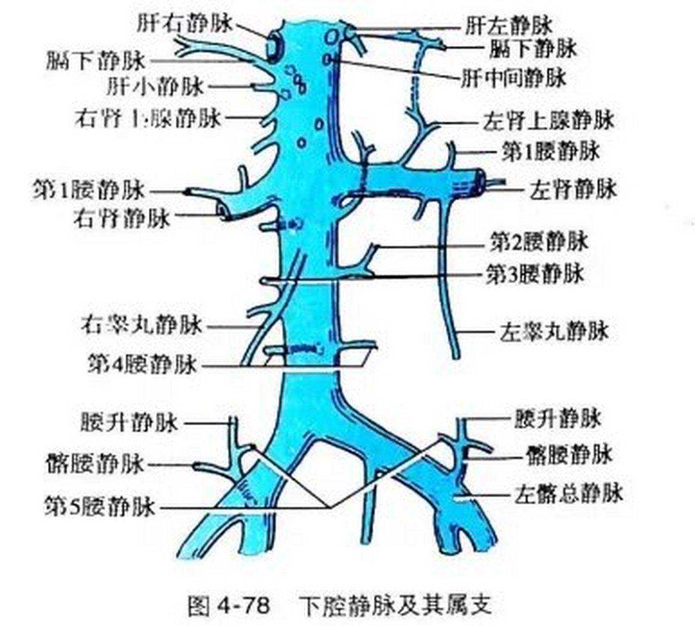 下腔静脉的属支有哪些 看图说话 下腔静脉属支有髂总静脉,右睾丸静脉