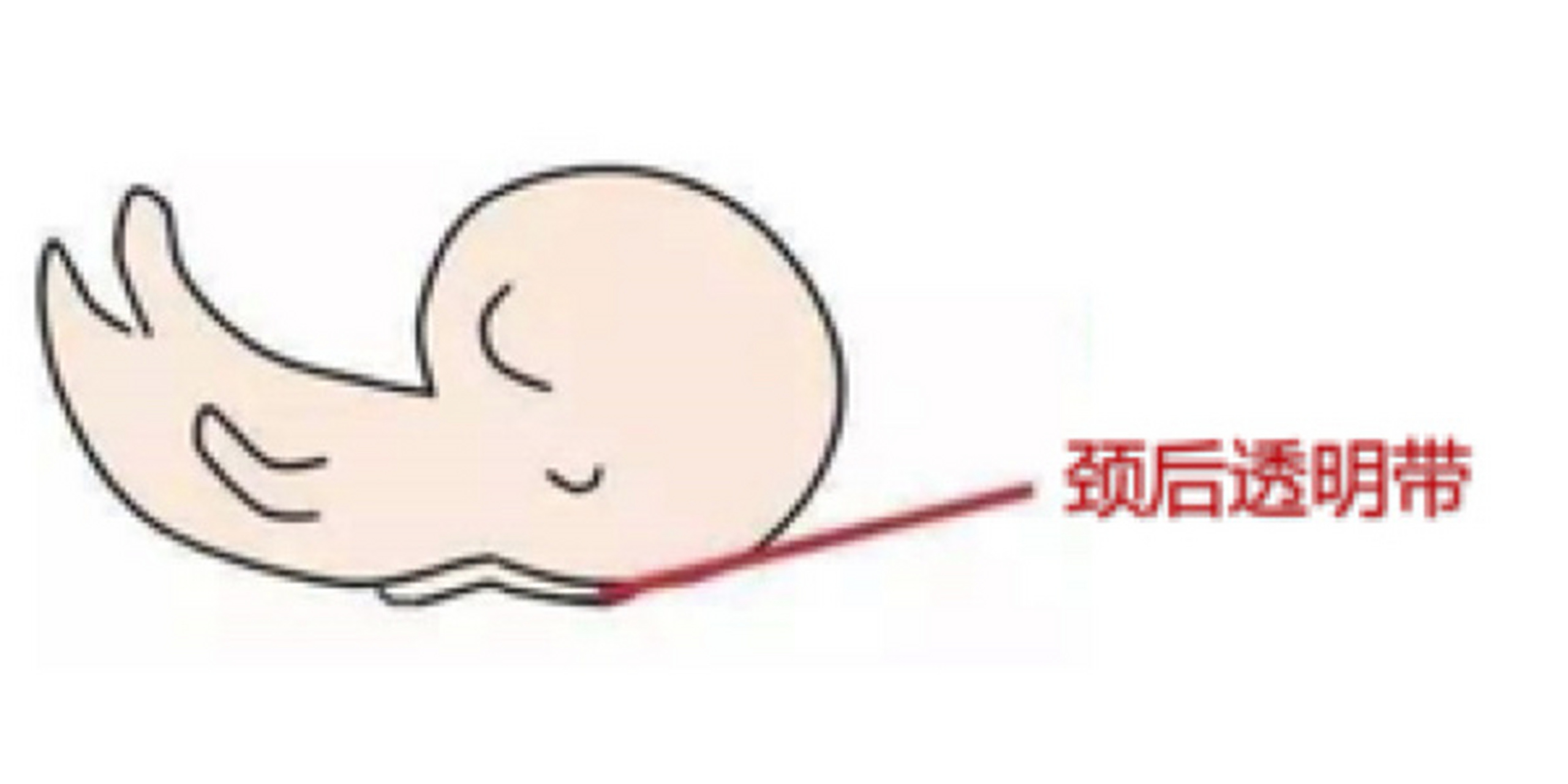 nt检查又称颈后透明带扫描,是通过b超来测量胎儿颈后透明带的厚度