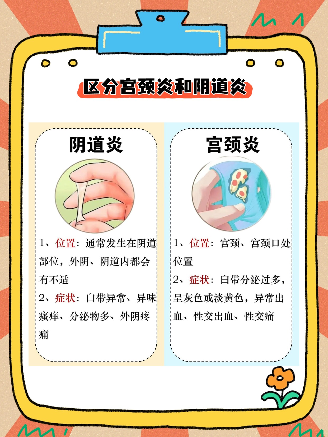 治疗宫颈炎的药分抗生素和中药