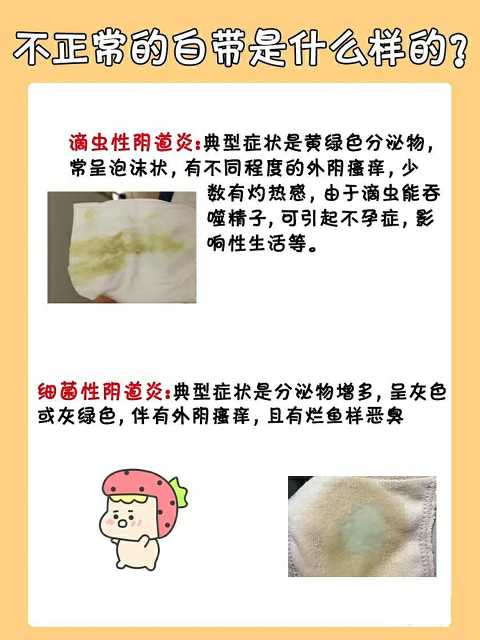 快来对比一下 你的白带什么样