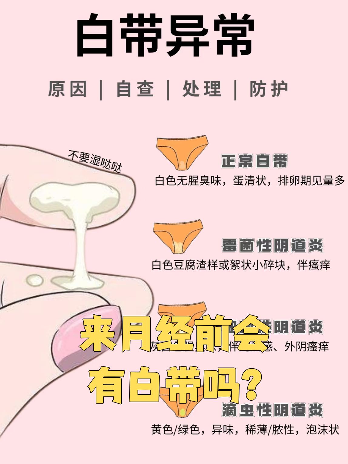 来月经前会有白带吗?