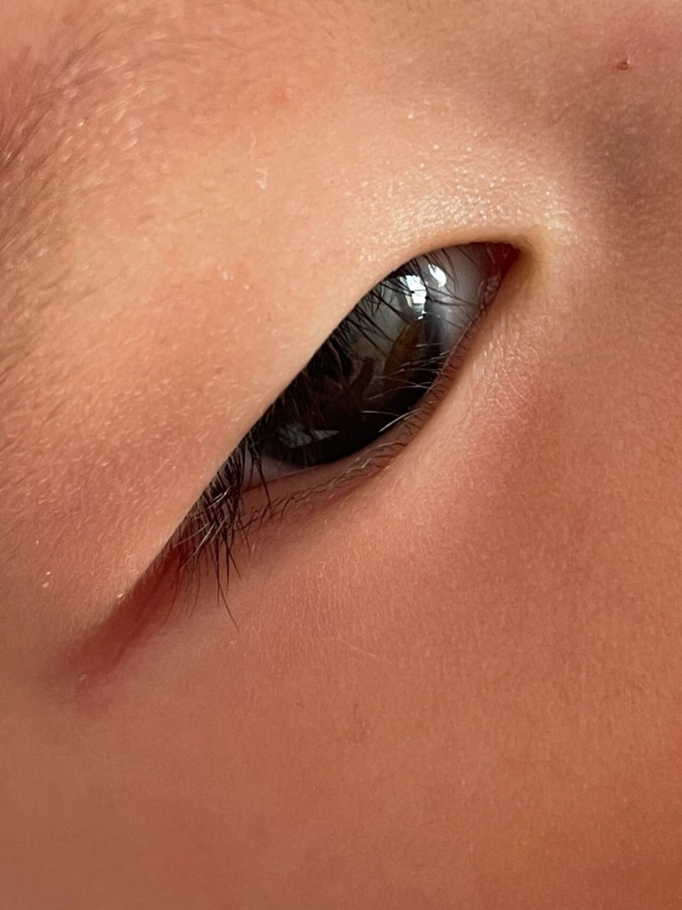 养娃真是心累,又来了新问题,倒睫毛!