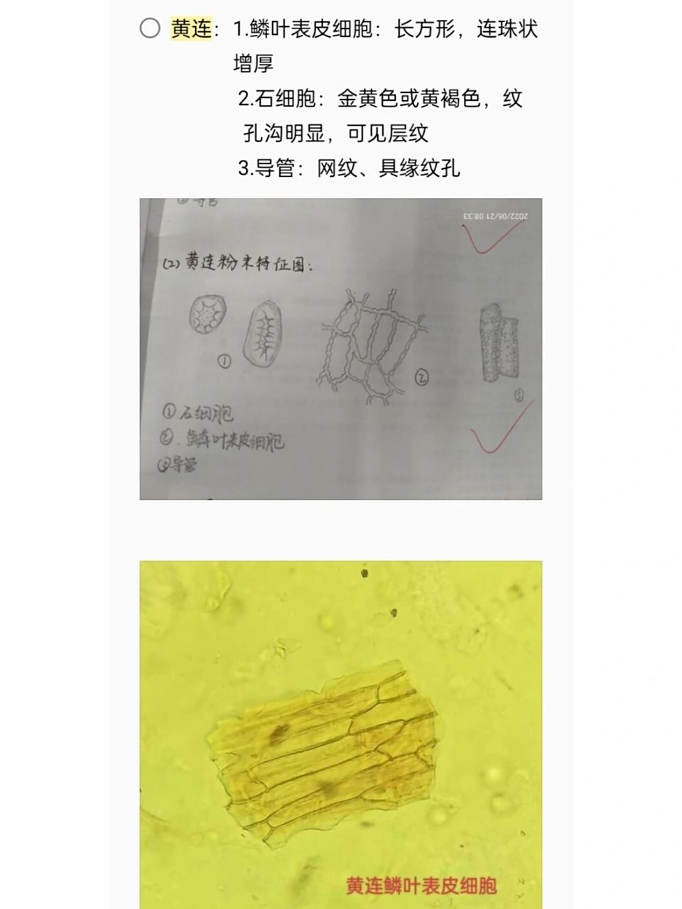 嵌晶纤维,砂晶 3.棕色块 4.表皮细胞碎片 2⃣黄连:1