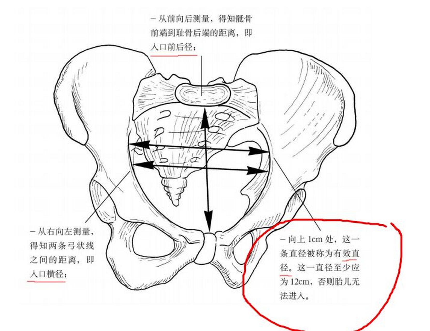 骨盆径线示意图图片