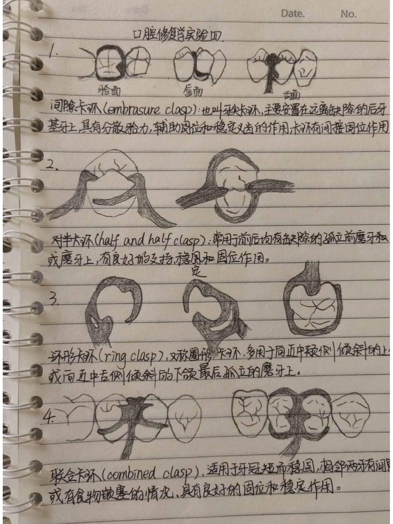 口腔修复学 可摘局部义齿