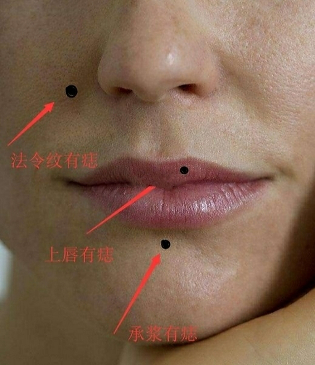 嘴巴周围最不好的三颗痣,如果你有希望你多加留心!