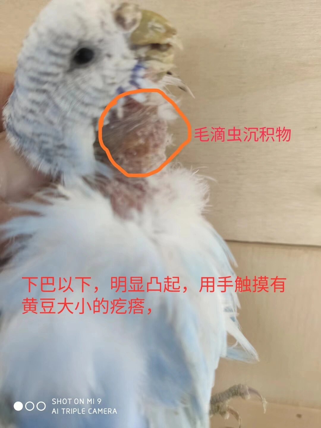 毛滴虫,每月来体检来喷嘴巴