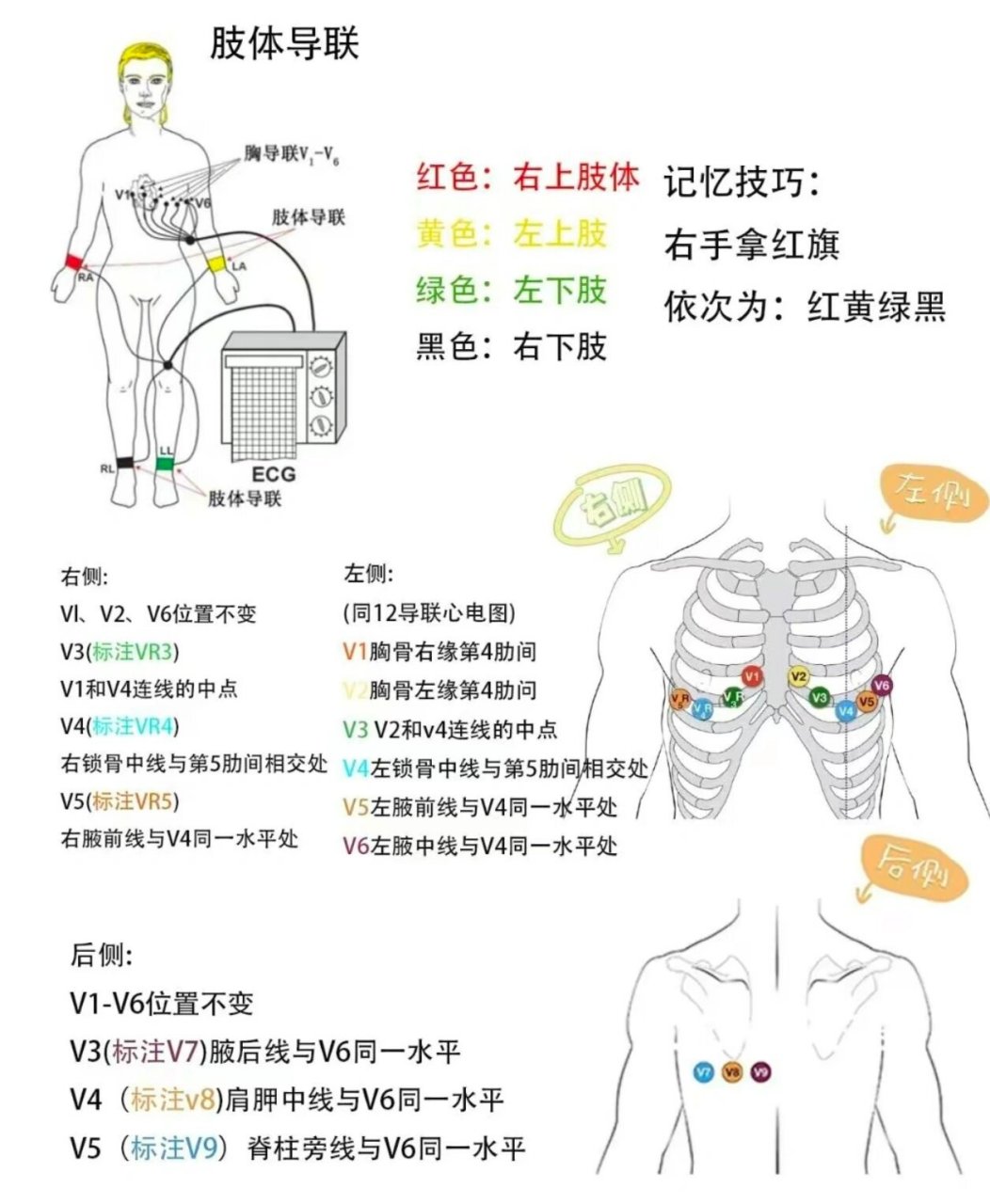 心电图导联位置 电极图片