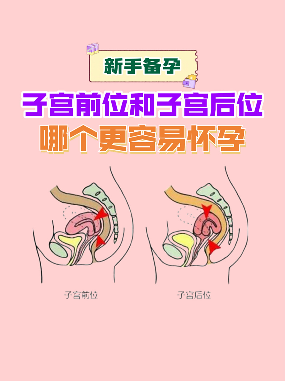 子宫前位和子宫后位哪和更容易怀孕 94子宫前位指的就是子宫颈向下