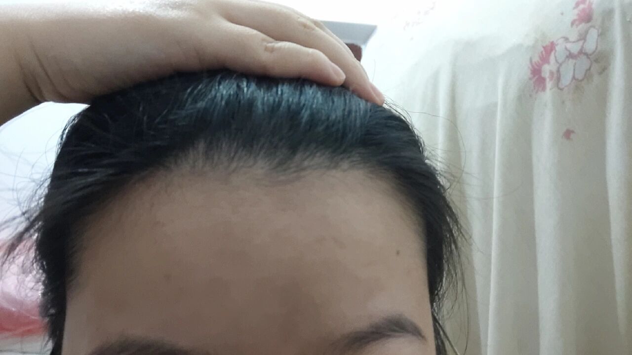 侧柏木的功效与作用点