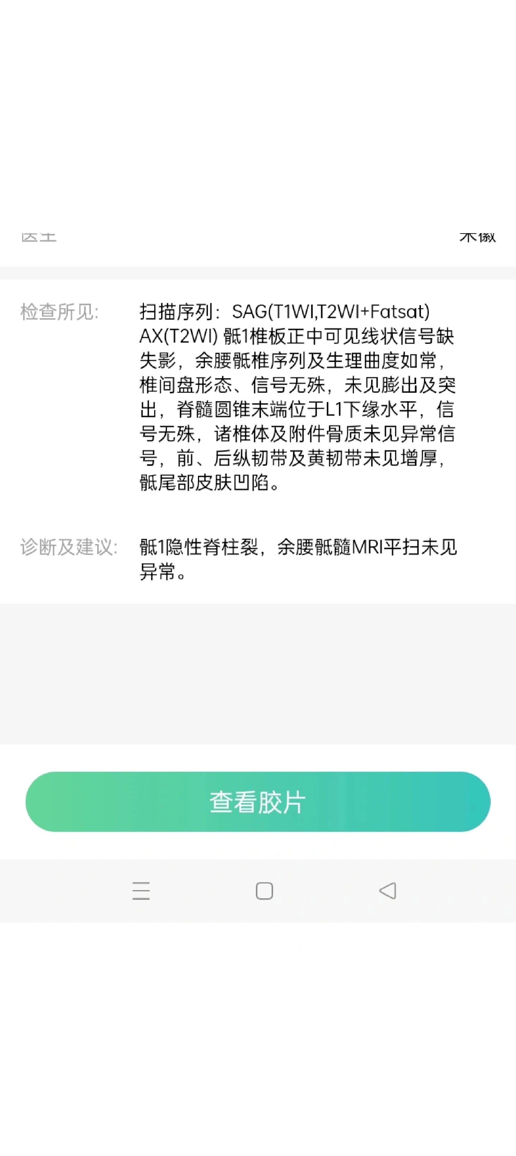 简单理解就是pp上方1