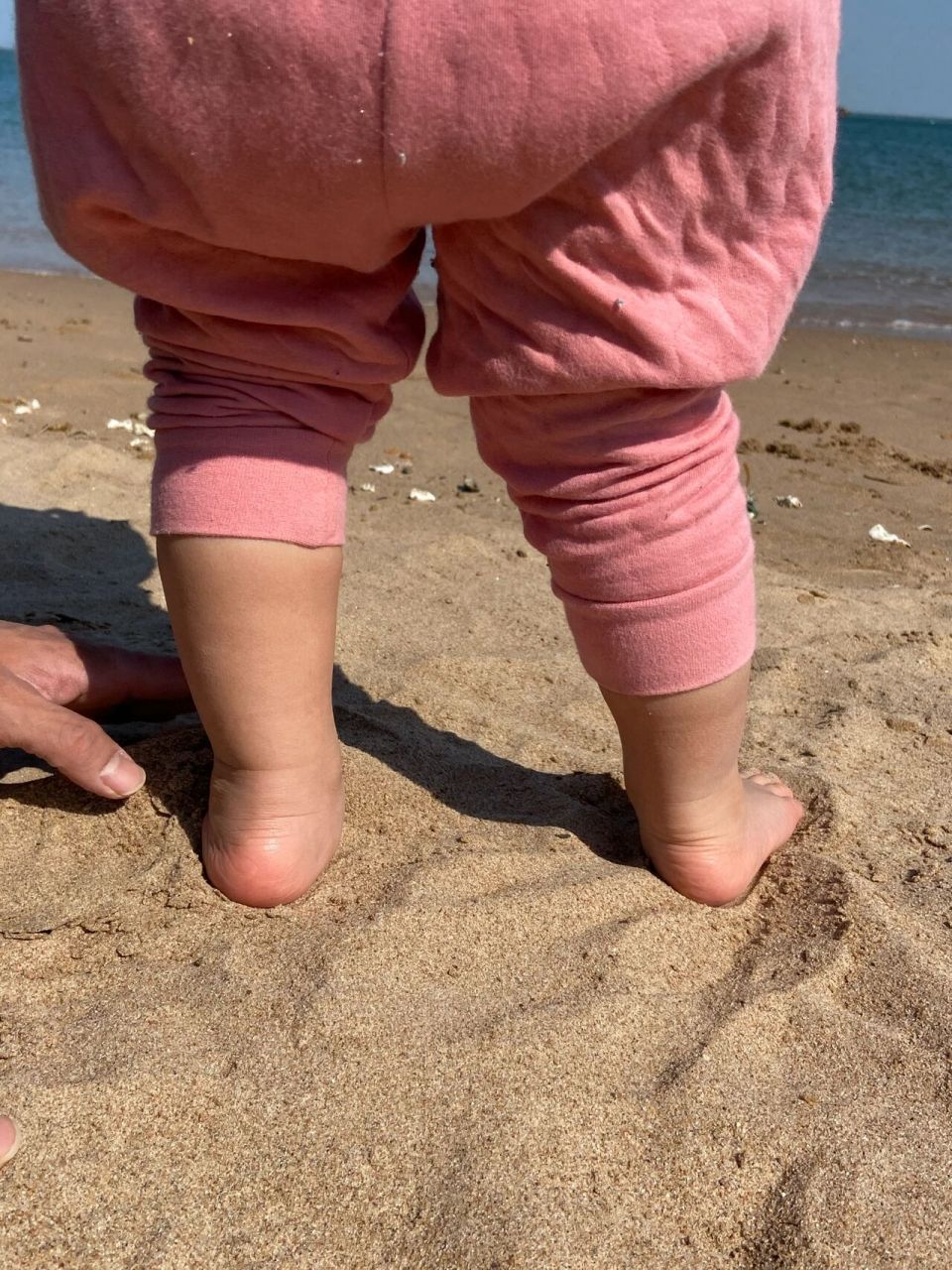 4⃣️【儿童足外翻】娃矫正一年效果  值得期待 铛铛铛铛 写了几