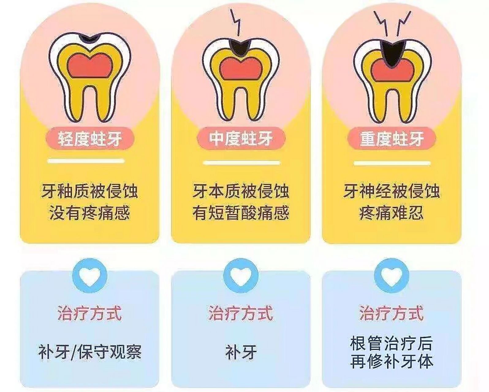 龋齿的形成过程图片图片