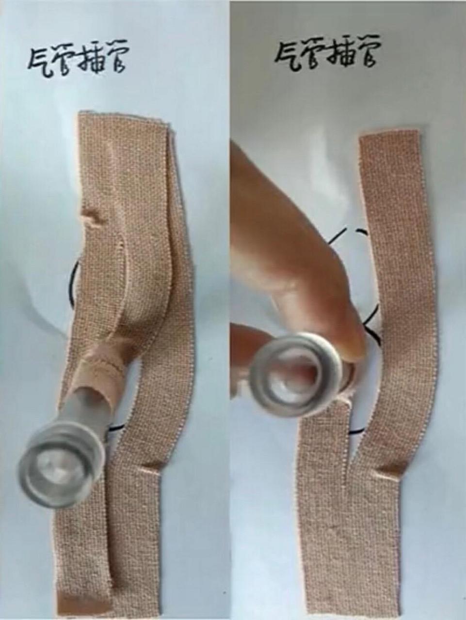 常用导管固定贴的不同剪法.