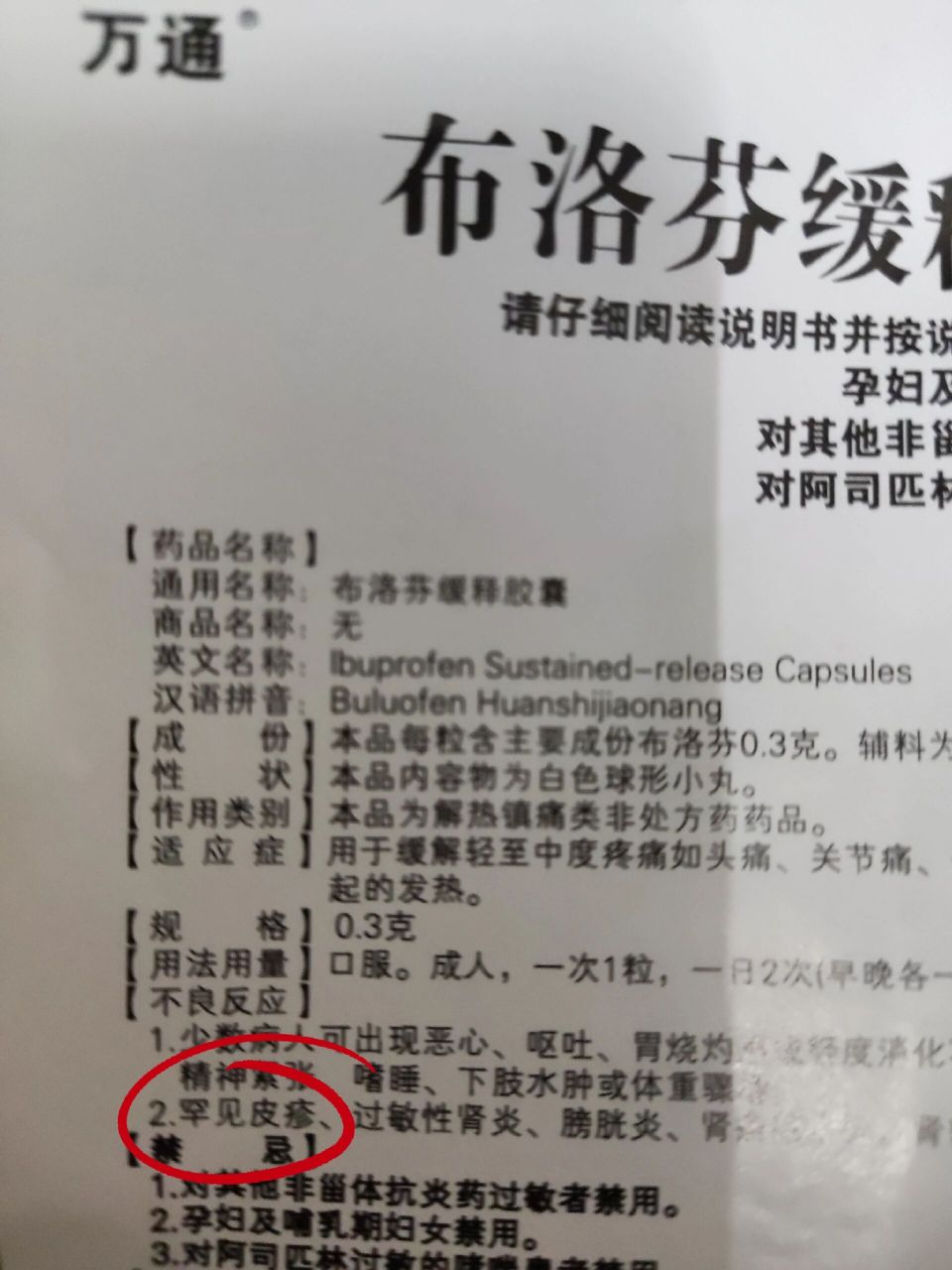 有人吃布洛芬出现皮疹吗 以前没吃过布洛芬,是放开后买回来备用的,阳