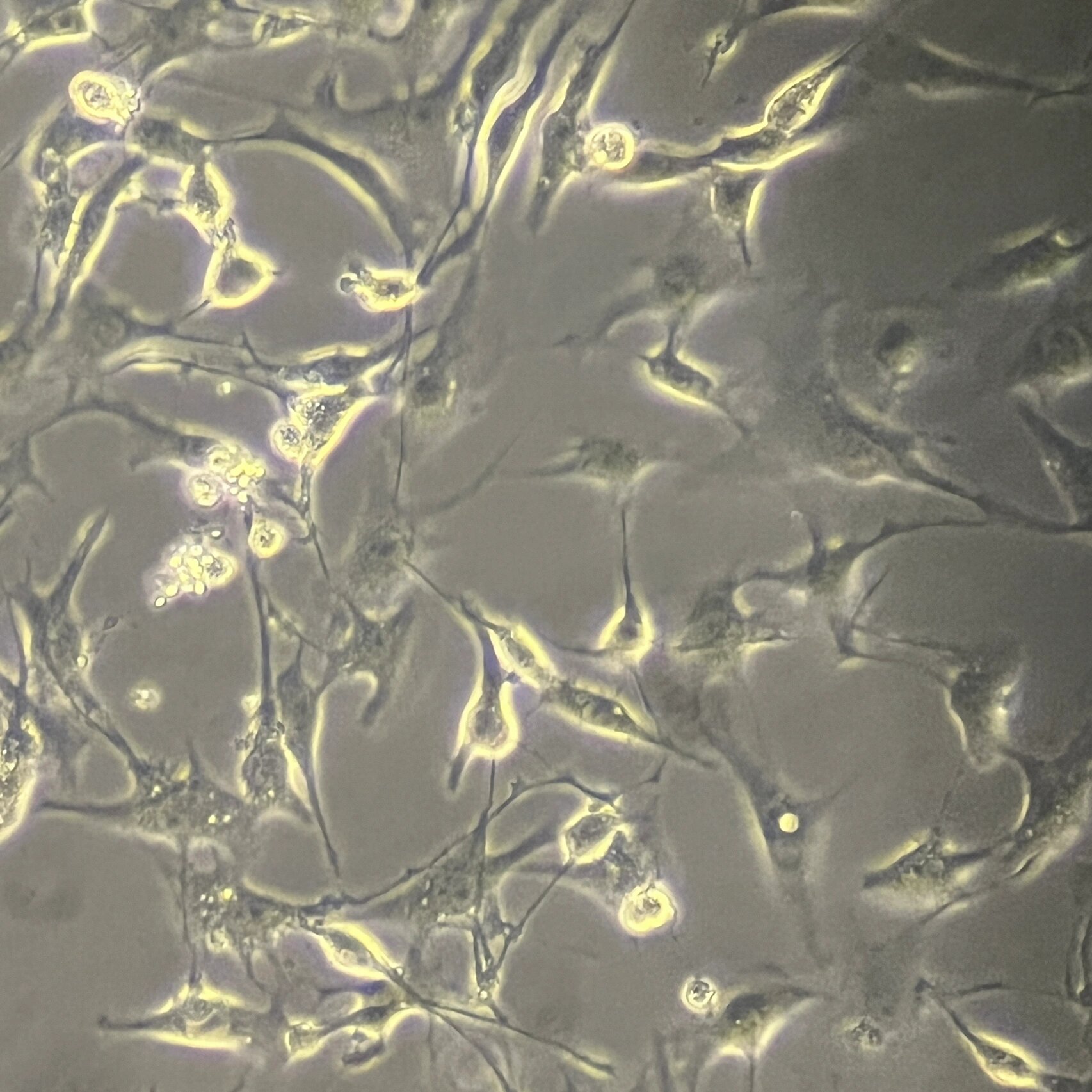 念珠菌污染细胞  念珠菌污染,需要仔细观察,会有成串的小葡萄样的小圆