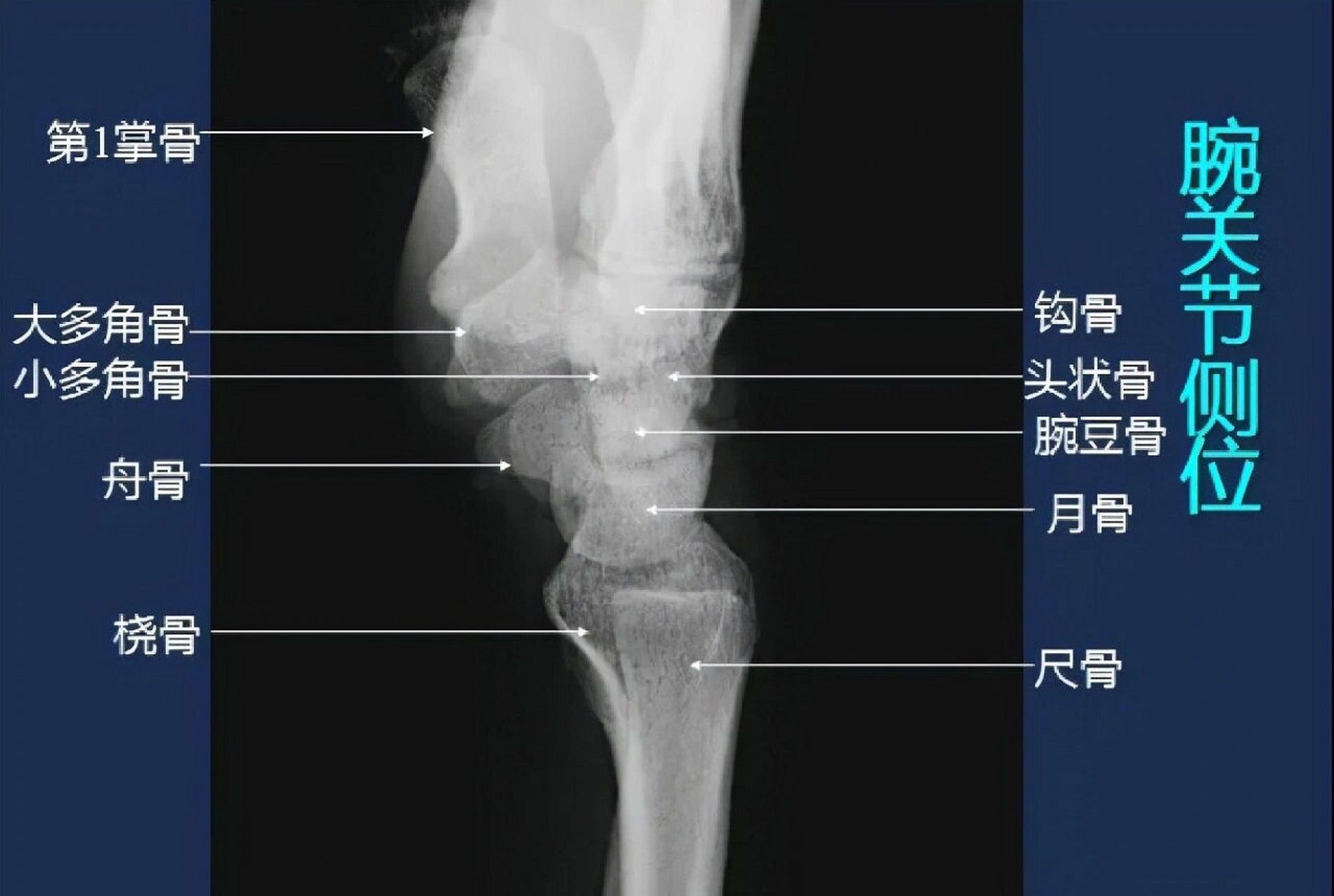 腕关节x线解剖图图片