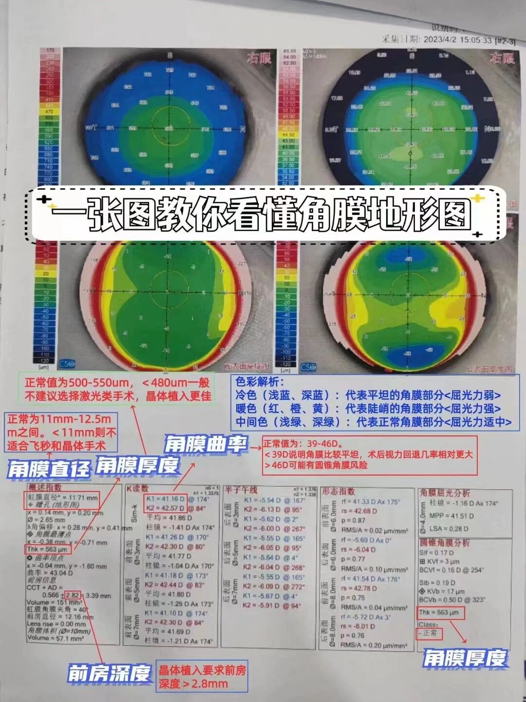 角膜地形图的解读图片