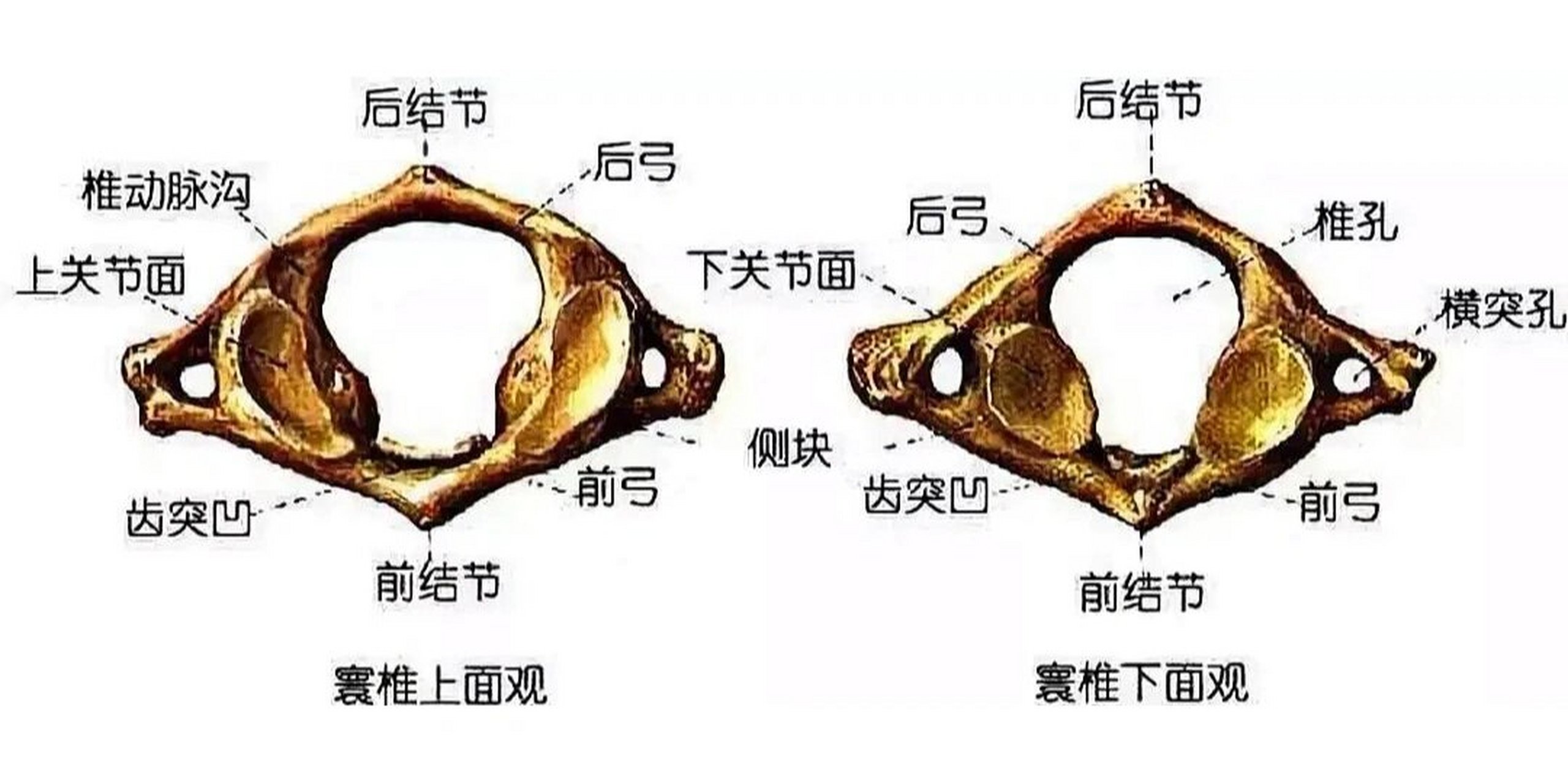 儿童寰枢椎不对称图图片