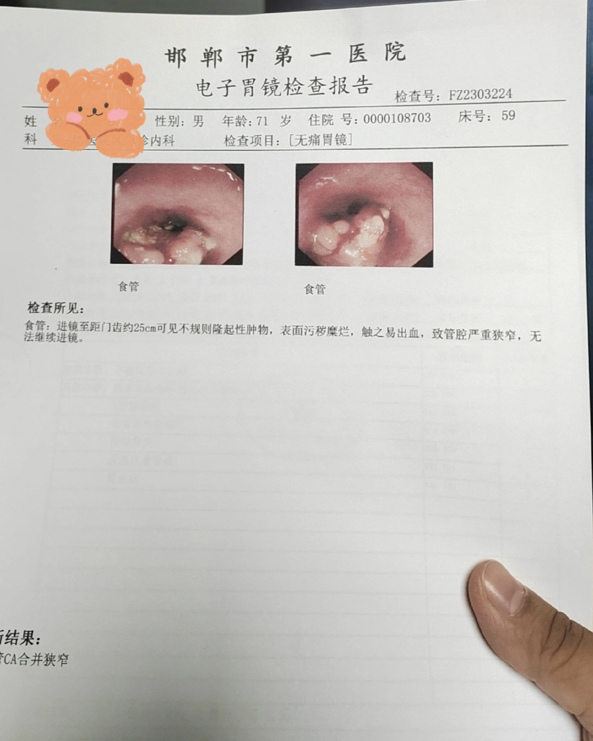 陪伴爸爸抗癌的日子