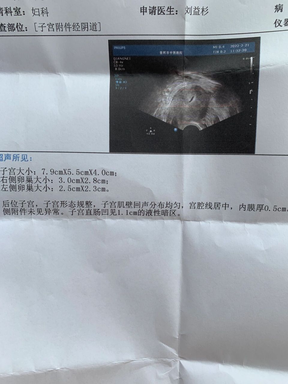 自然流产后有残留,不用清宫成功上岸分享篇, 14号自然流产了,流出来