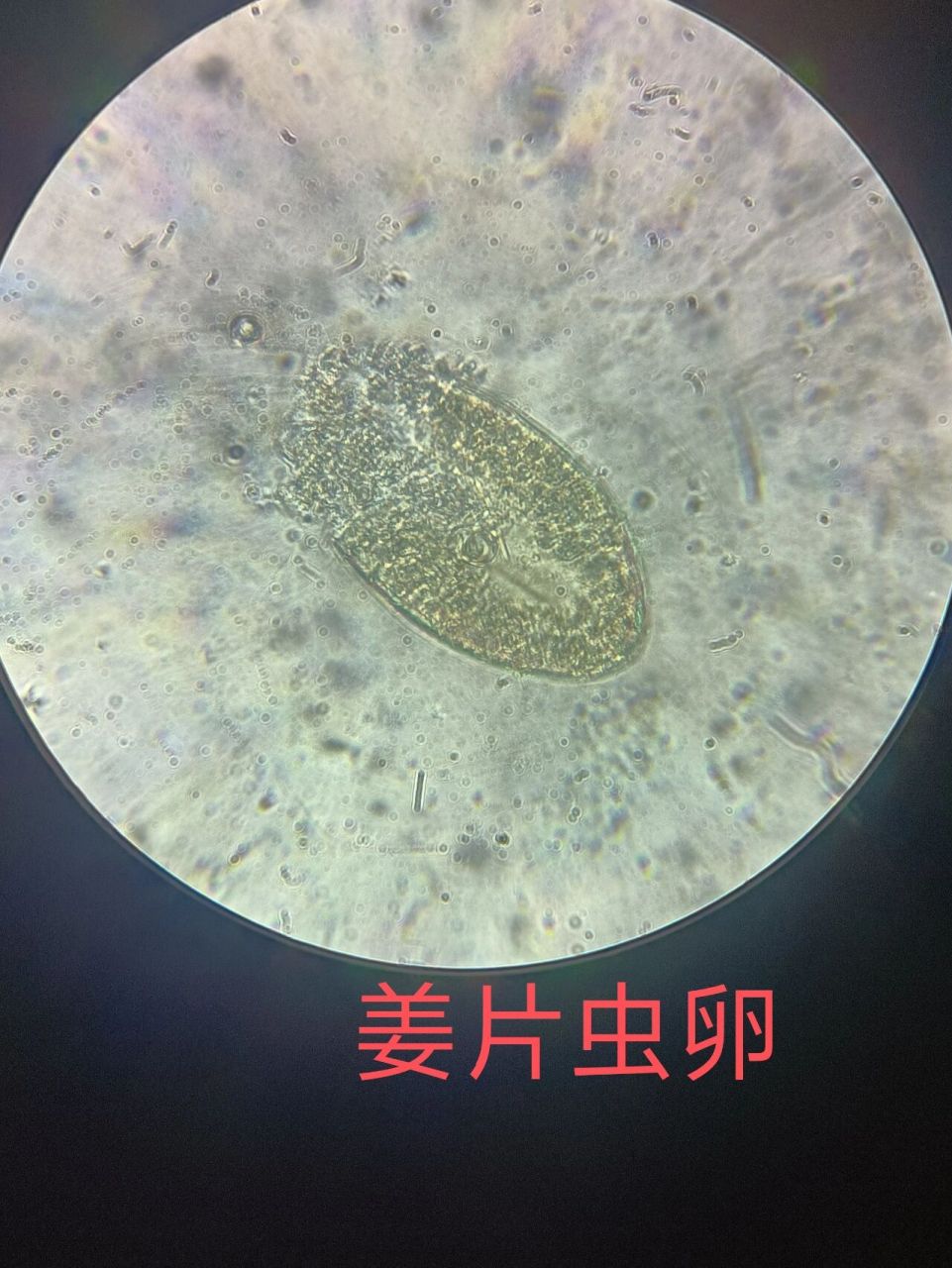 布氏姜片吸虫虫卵结构图片