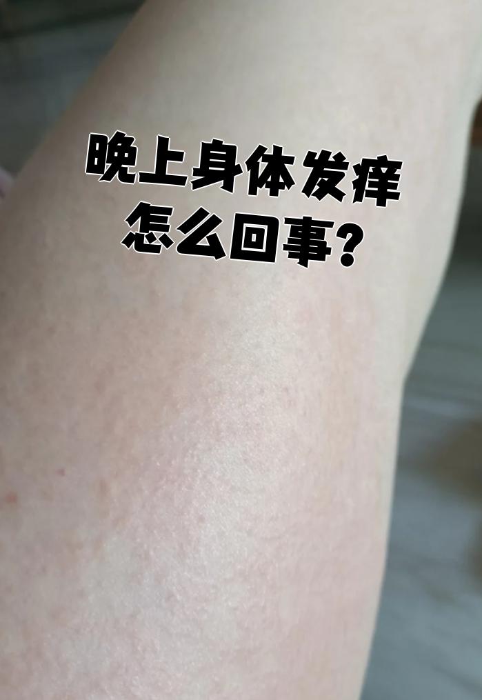 为什么浑身发痒