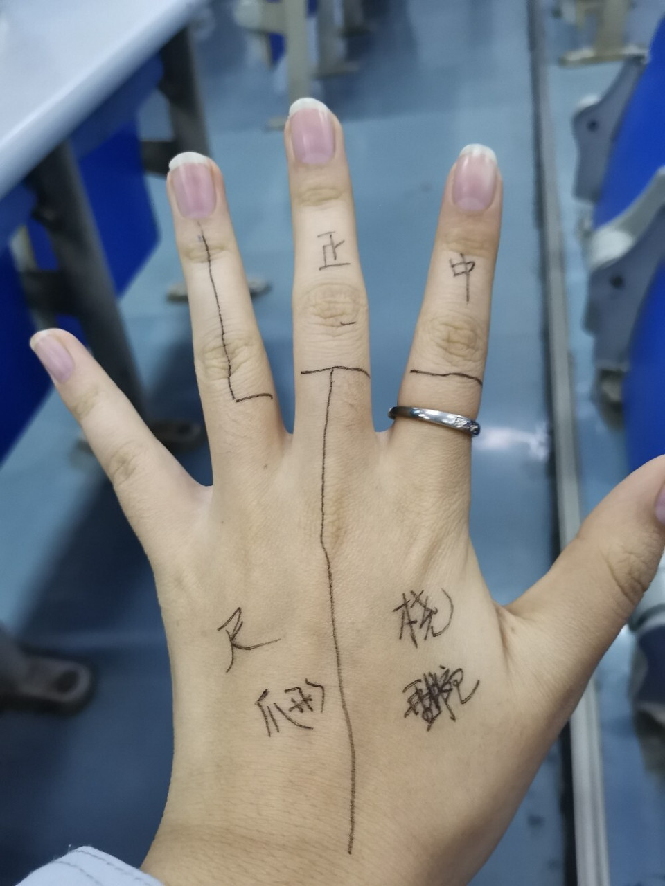 74桡神经损伤导致垂腕 74尺神经损伤导致爪形手 74正中神经