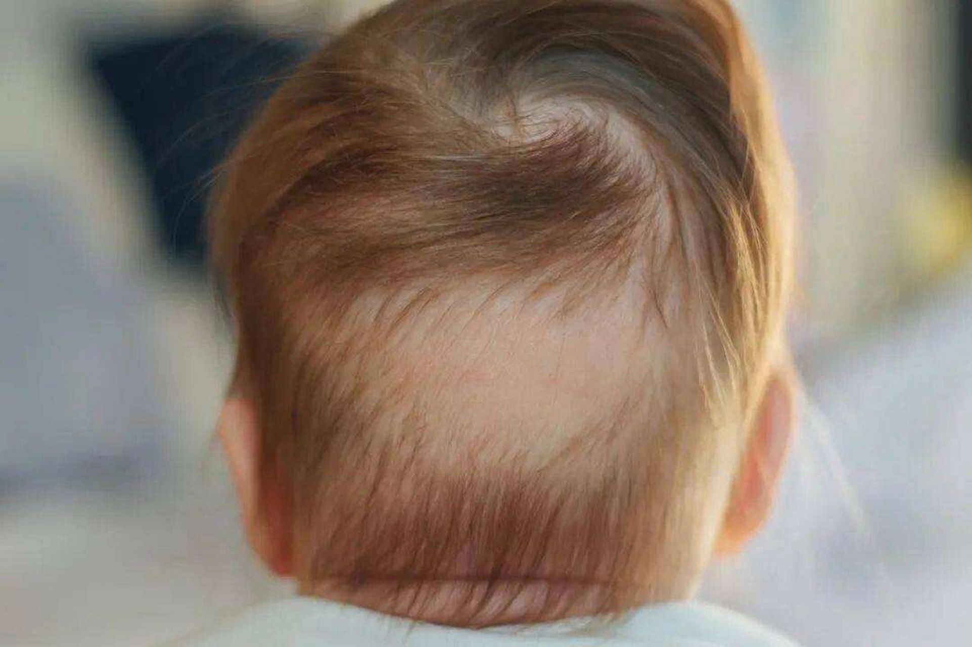 【第758篇】1岁左右的宝宝头发稀少该怎么办 202112