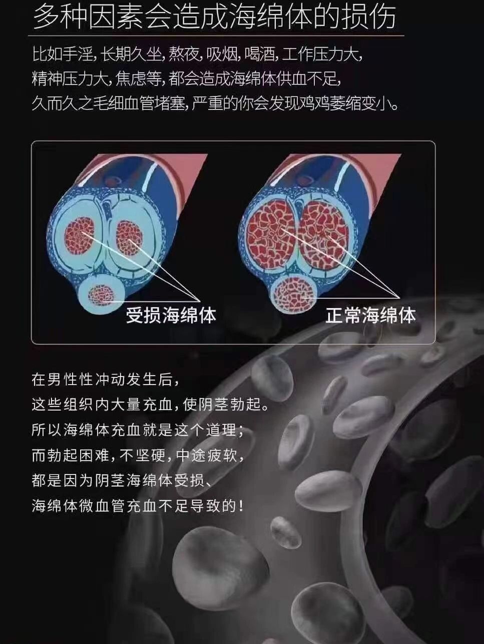 海绵体受损介绍
