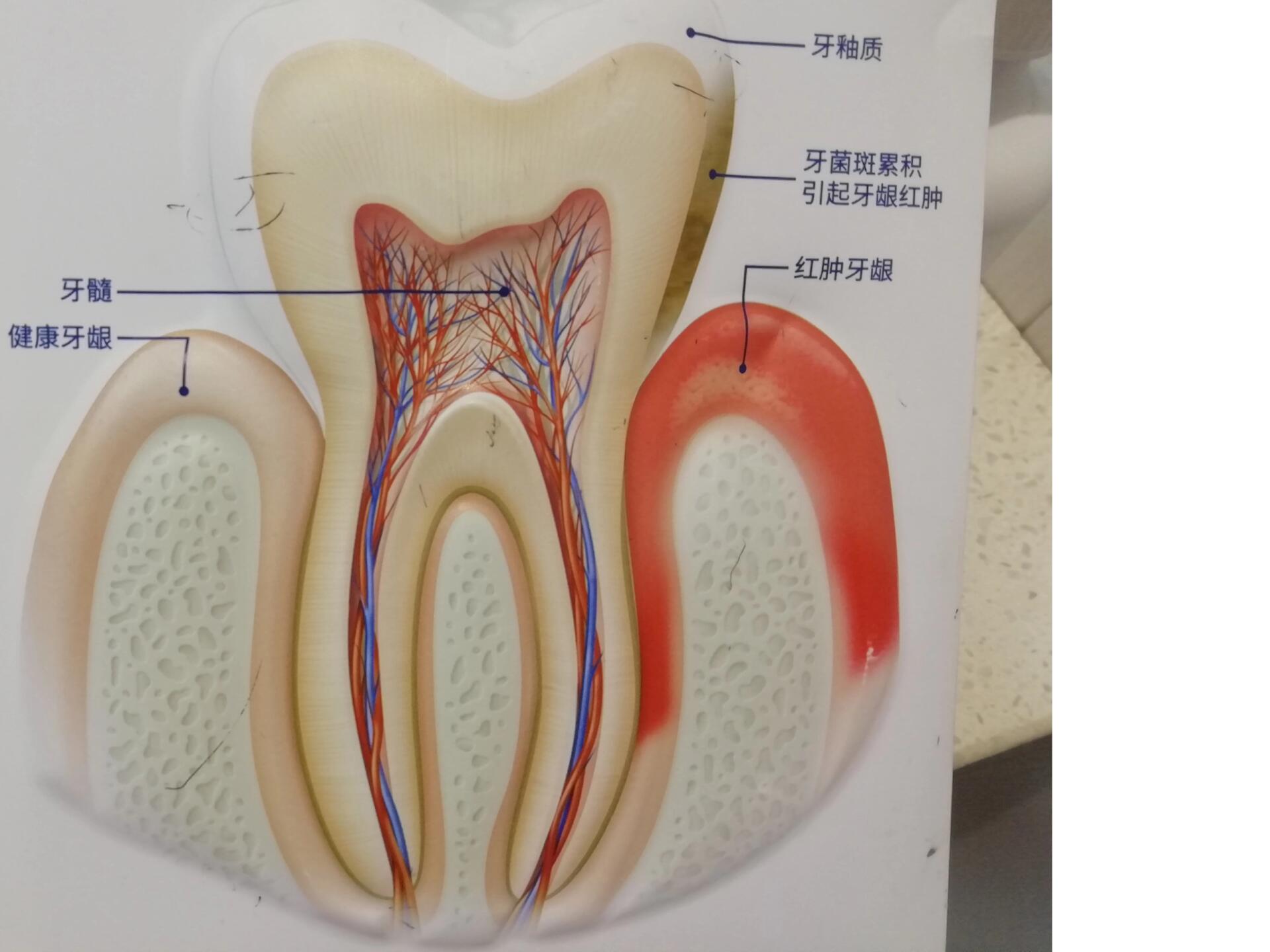牙龈萎缩了,还能再恢复吗?