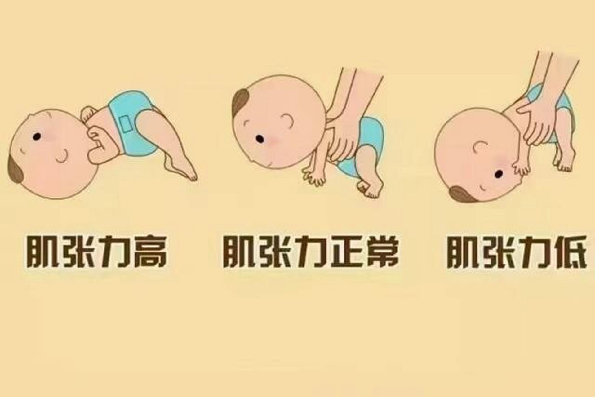 甲减宝宝有哪些特征 甲减宝宝的哪些特征?