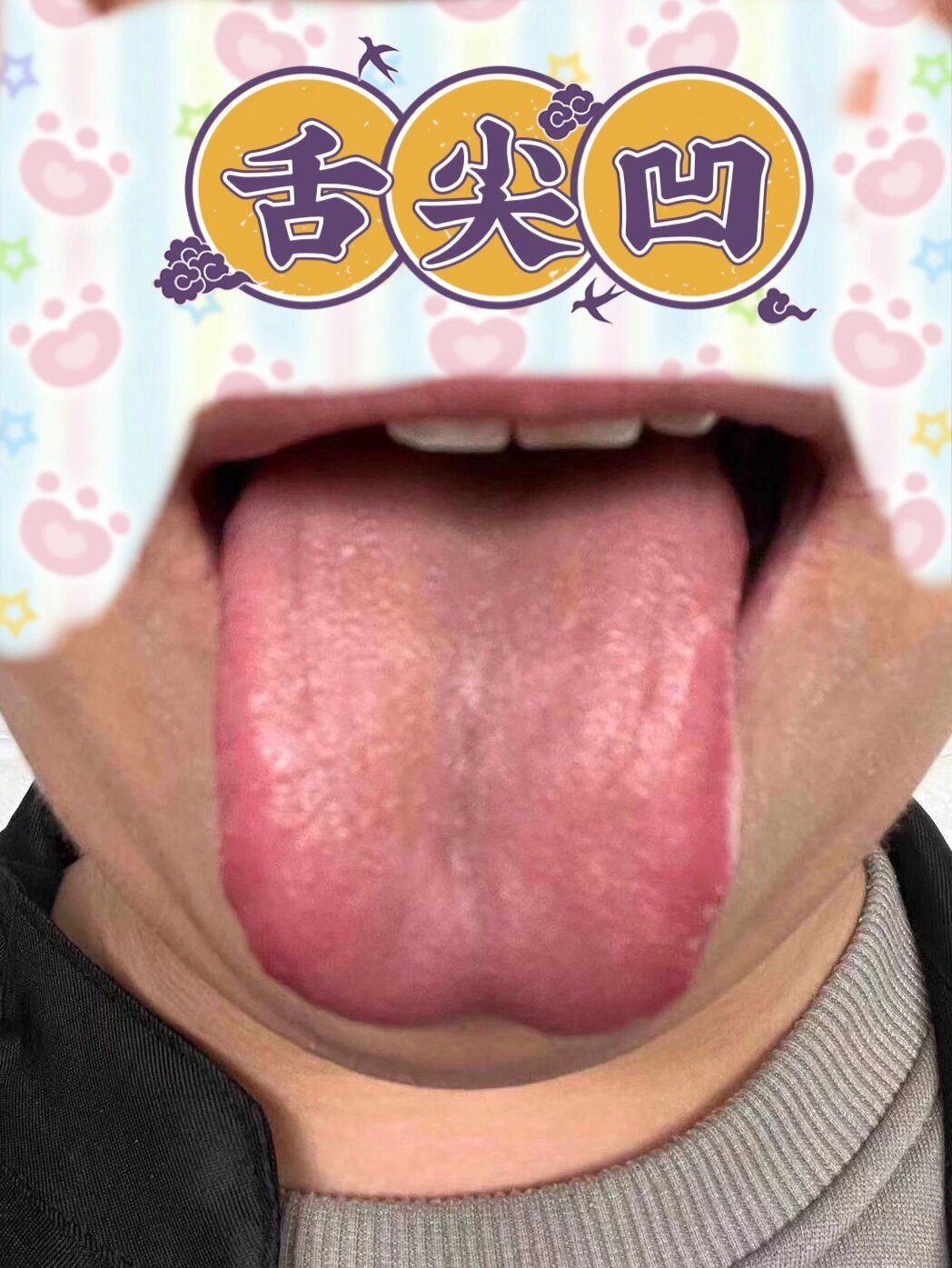 是血液,汗液等