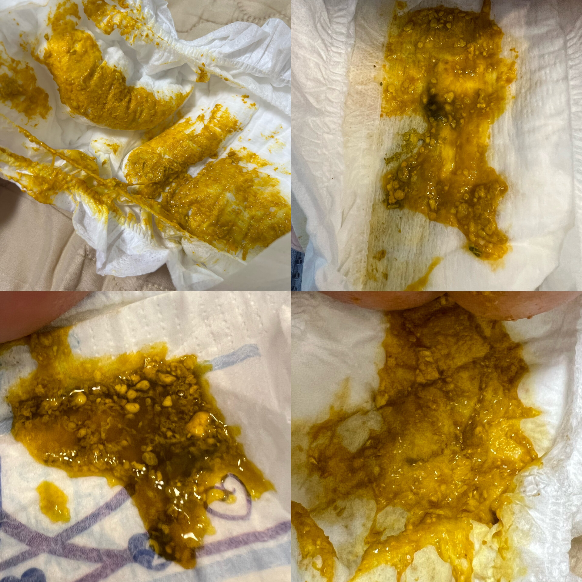 急急急!两个半月宝宝一天5