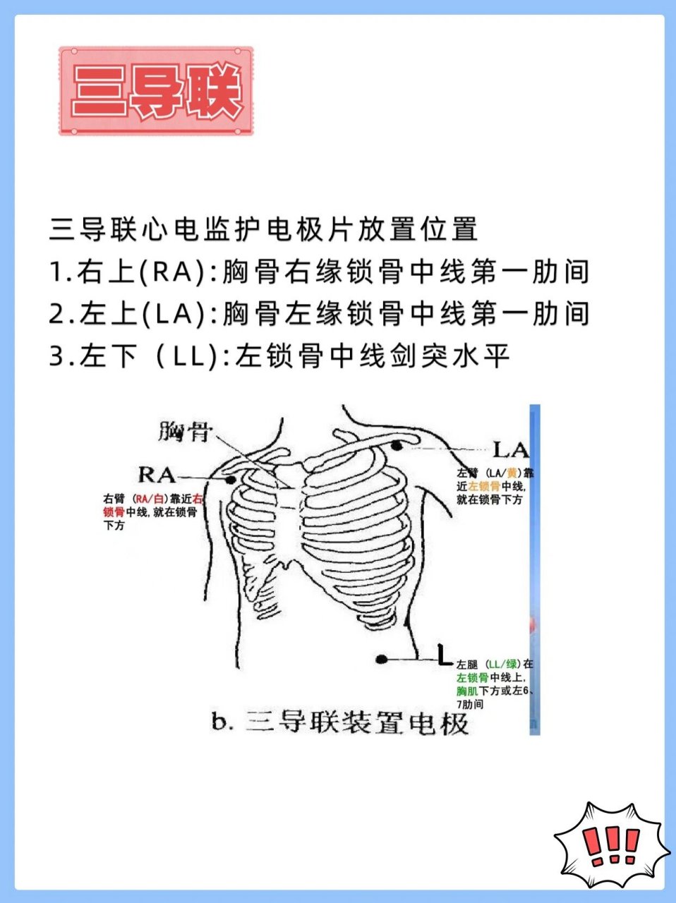 胸导联位置图片图片