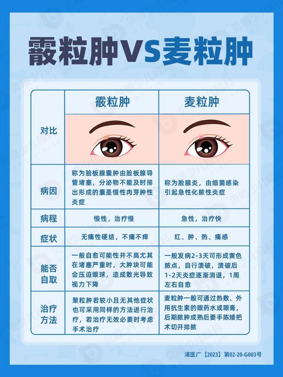 原来差别这么大‼ 1⃣病因不同 麦粒肿和霰粒肿是两种常见的眼疾