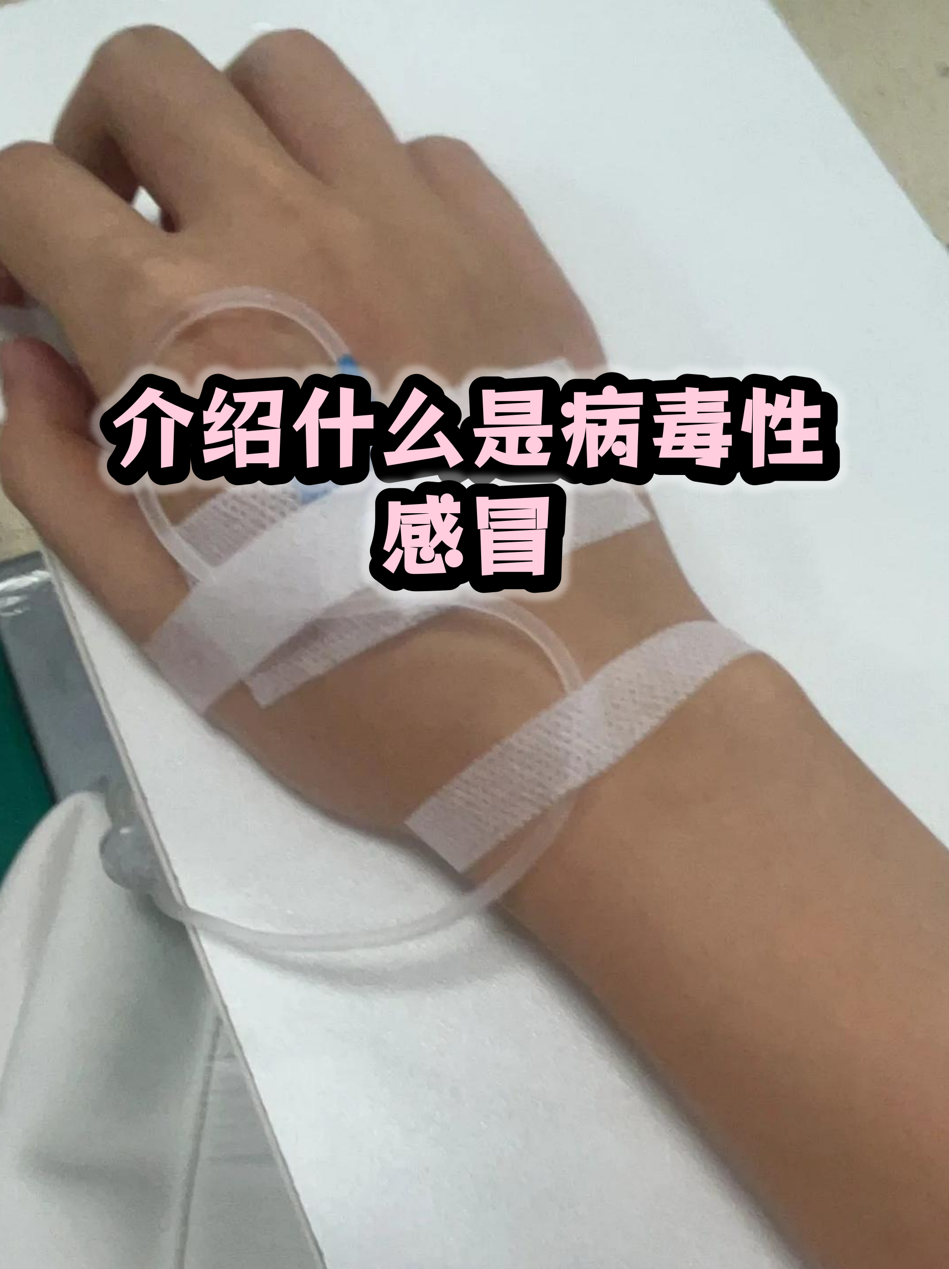  最近有病毒性感冒吗(感冒自愈的最快方法)