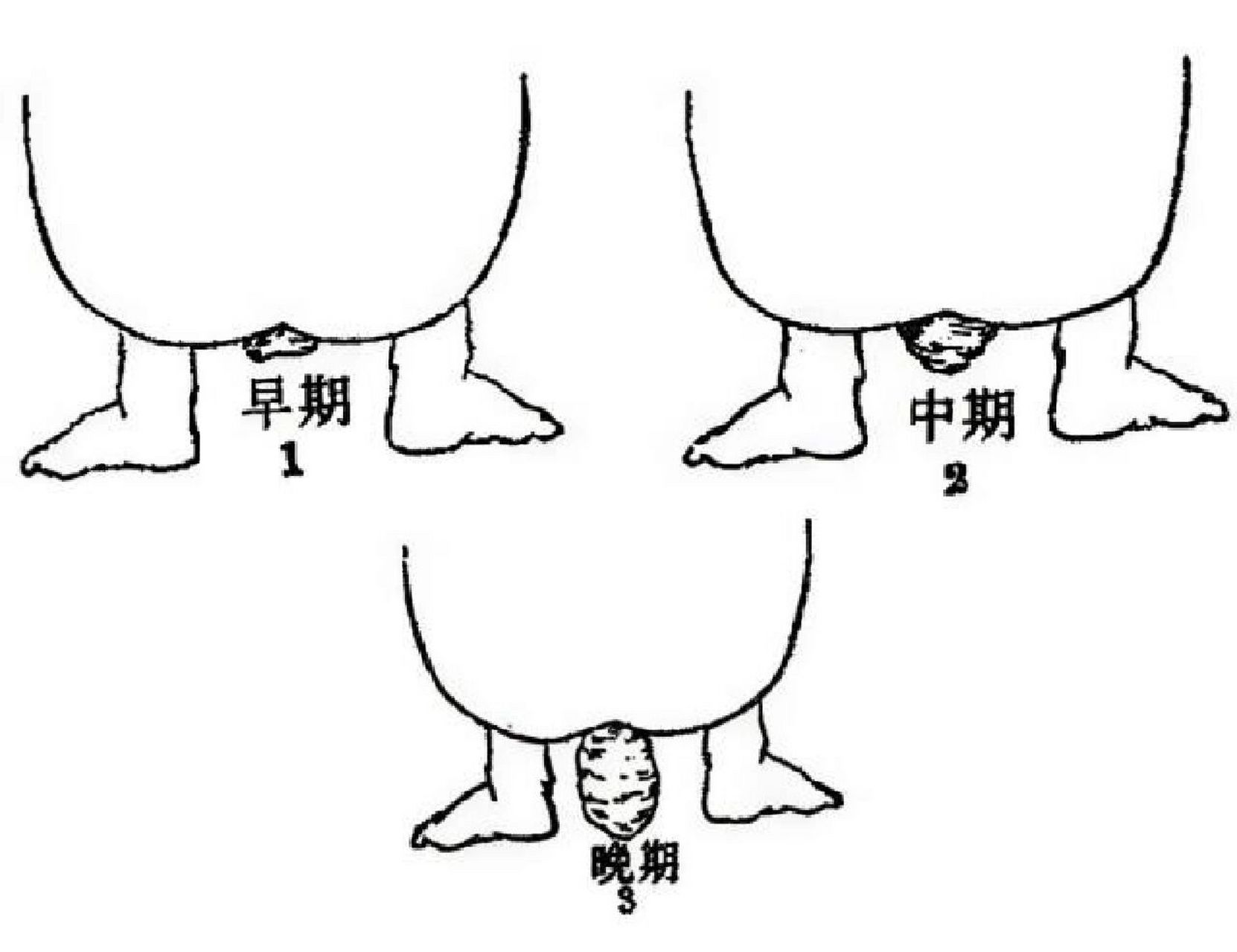 鹦鹉鱼脱肛怎么治疗图片